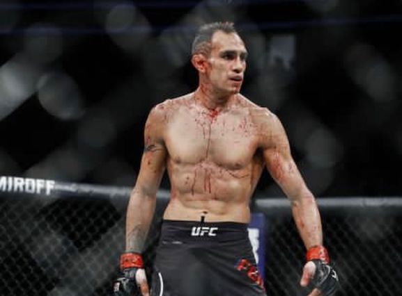 تونی فرگوسن کیست؟ | بیوگرافی مبارز معروف UFC با آمار پیروزی بالا (+عکس)